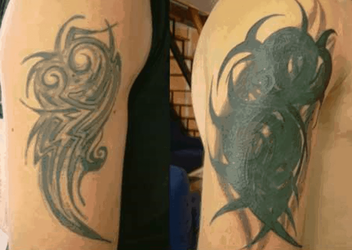 bad-cover-up-tattoo-for-removal.png