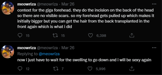 giga forehead.PNG