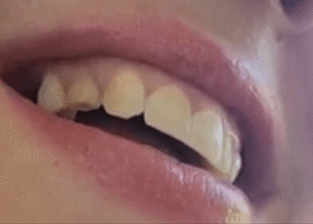 Hnet.com-image.gif