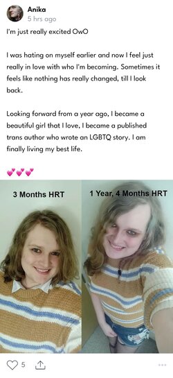Anika before after.jpg