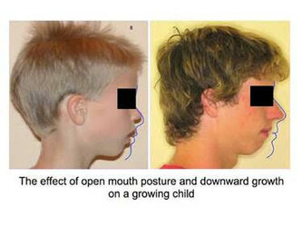 pediatric-sleep-six.jpg