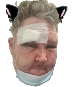 CB3.png