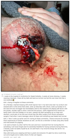 scrotum horror.png