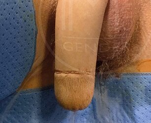 hairy tip.jpg