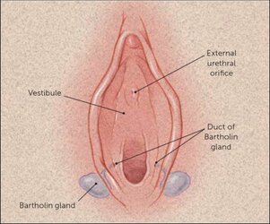 bartholin 4.JPG