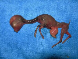 aborted-fetus-multiple-abnormalities-tibary-sized.jpg