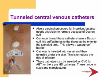 essentials-of-vascular-access-11-638[1].jpg