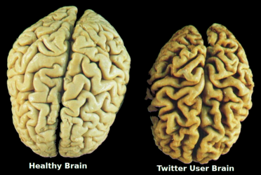 twitter brain.png