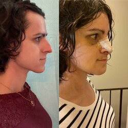1-7d-profile-comparison.jpg