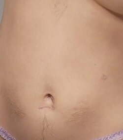 hairy belly.jpg