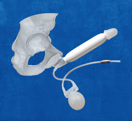 ED-Inflatable-Penile-Implant-ZSI-475-FTM-4.jpg