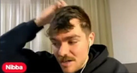 bald.png