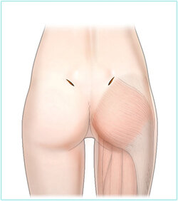 en_pelvic02.jpg