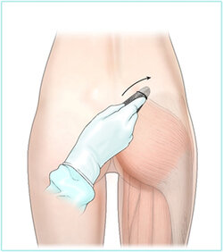 en_pelvic03.jpg