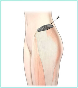 en_pelvic04.jpg