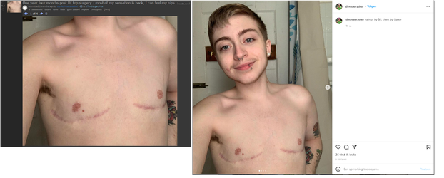 same tattoo lol.png