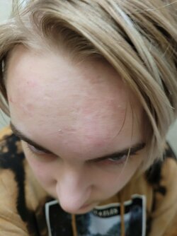 pimpl2.jpg