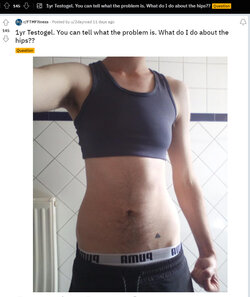 The_skin_ur_in.jpg