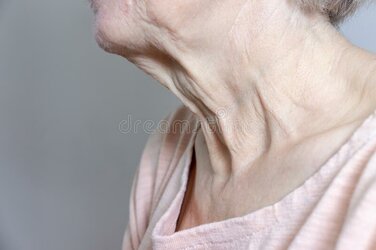 flabby-wrinkled-excess-skin-neck-senior-woman-close-up-171616138 (1).jpg