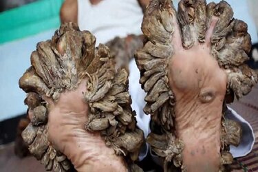 treeman 3x2.jpg
