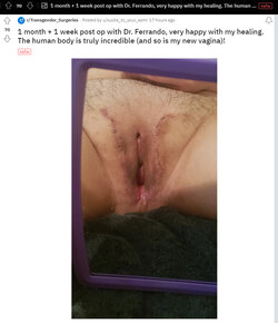 Literal_axewound_neovag.jpg