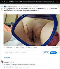 Literal_axewound_neovag2.jpg