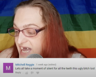 ugly_bitch_teeth.png
