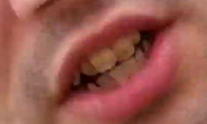 digiteeth5.png