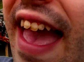 digiteeth3.png