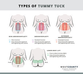 typesoftummytuck-desktop.jpg