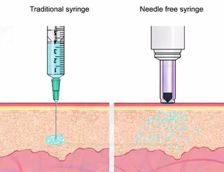needle.jpg