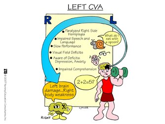 Cerebral+Vascular+Accident+-+Left[1].jpg