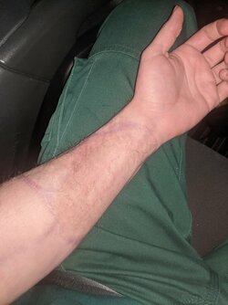 Arm.jpeg