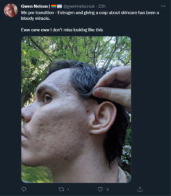 1.PNG