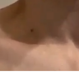 bug.png