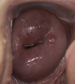 age-27-day-22-wv.jpg
