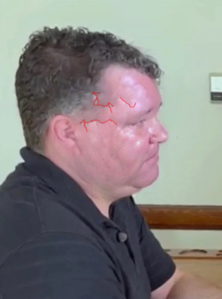 scar.png