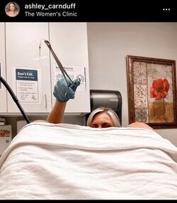 20220818-AshC-IUD.jpg