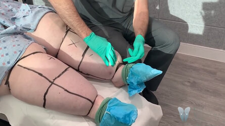 Lipedema & Lymphedema - Ankle Cuffing.jpeg