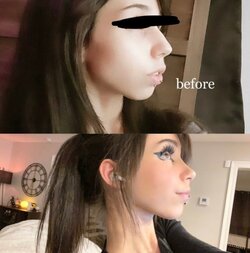 nose.jpg