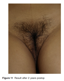 1662690117546.png