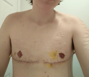 l1k1dnhl5yl91.png
