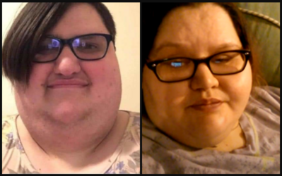 Obesity and Gender.png