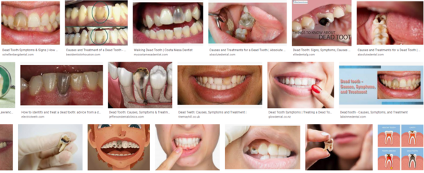 dead teeth.png