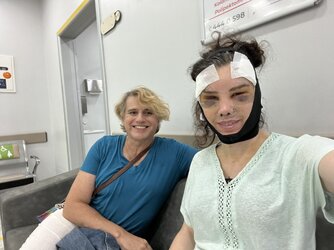 day 4 surgery.jpg