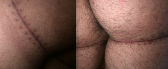 tumblr_inline_oz5yxiJcy91s40lo3_540(1).png