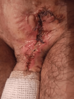 5hyc6vl0mhv91.png