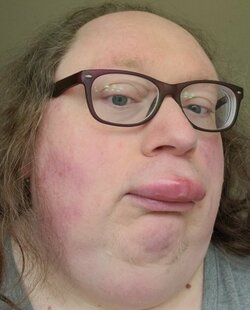 slugphixy.jpg