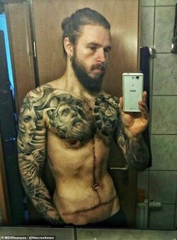 LA Man - Skin Removal Tattoos 01.jpg