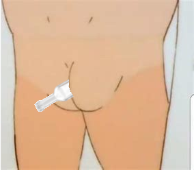 rackets ass.png